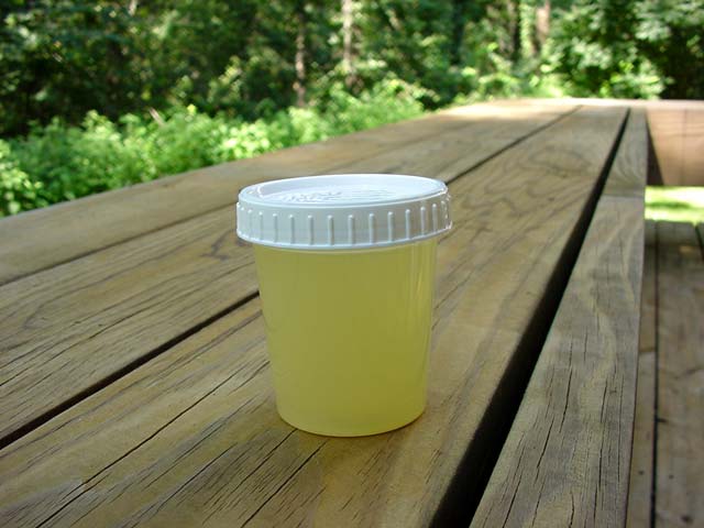 Cloudy Urine